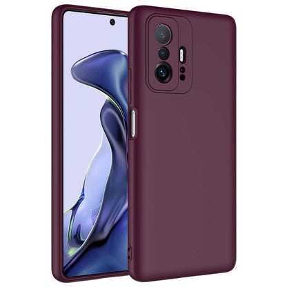 Xiaomi Mi 11T 5G Kılıf Zore Mara Lansman Kapak